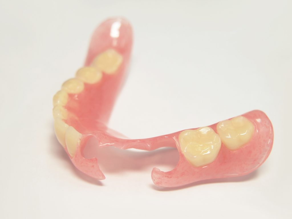 金属を用いない入れ歯