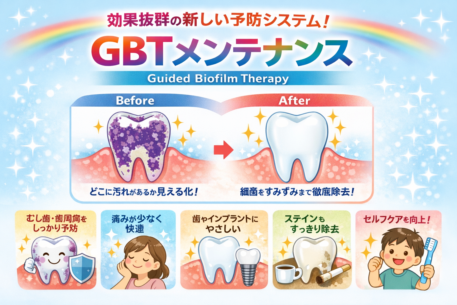 GBTメンテナンス