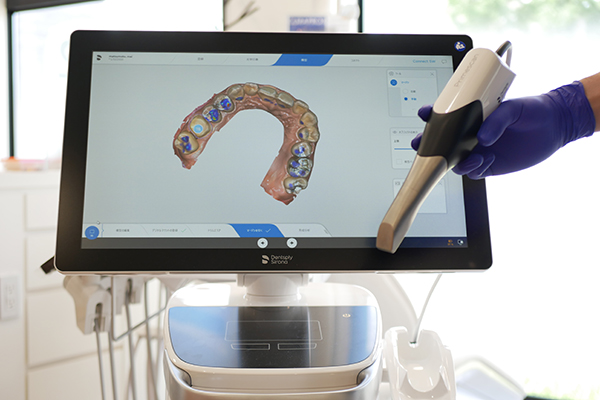 口腔内スキャナーについて