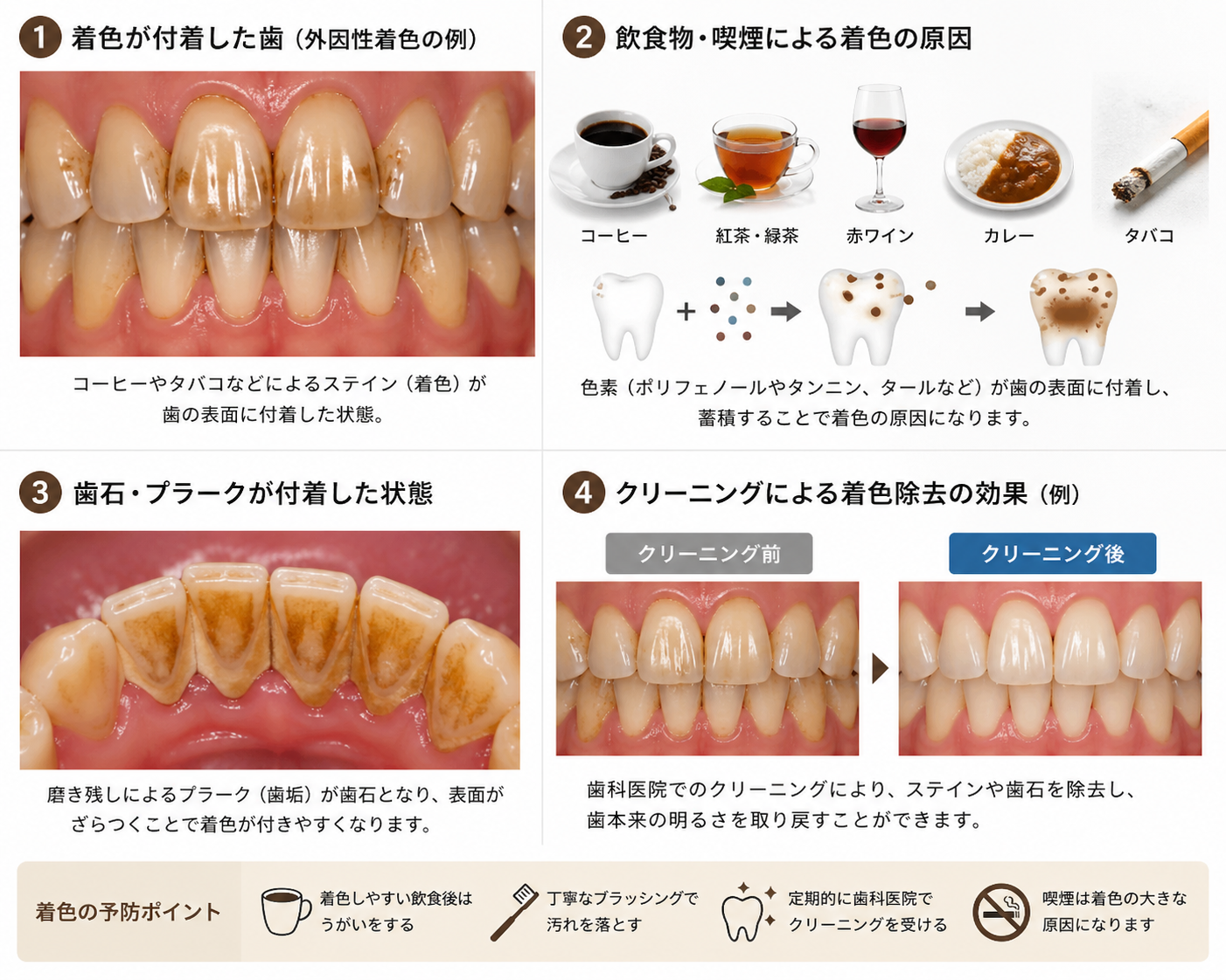 歯の着色の原因と対策について
